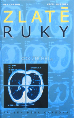Zlaté ruky - Príbeh Bena Carsona